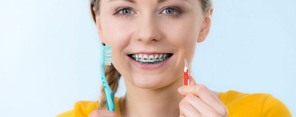 Curatarea dintilor dupa purtarea aparatelor dentare