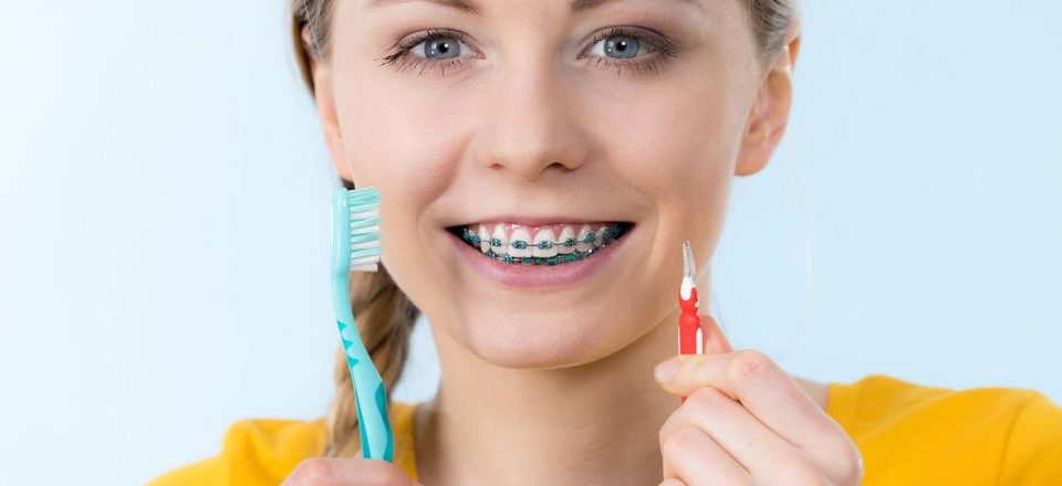 Curatarea dintilor dupa purtarea aparatelor dentare